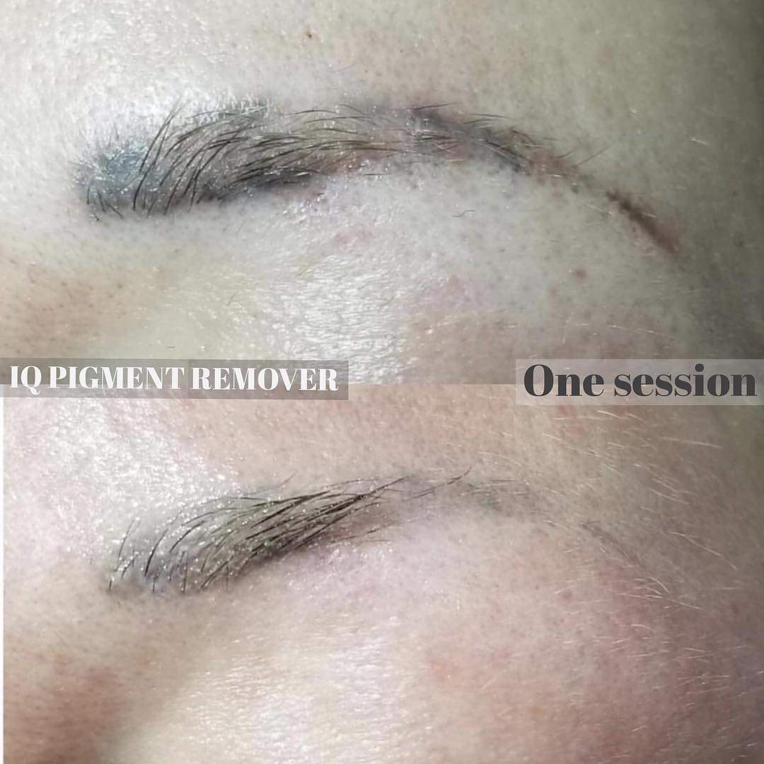 sourcils